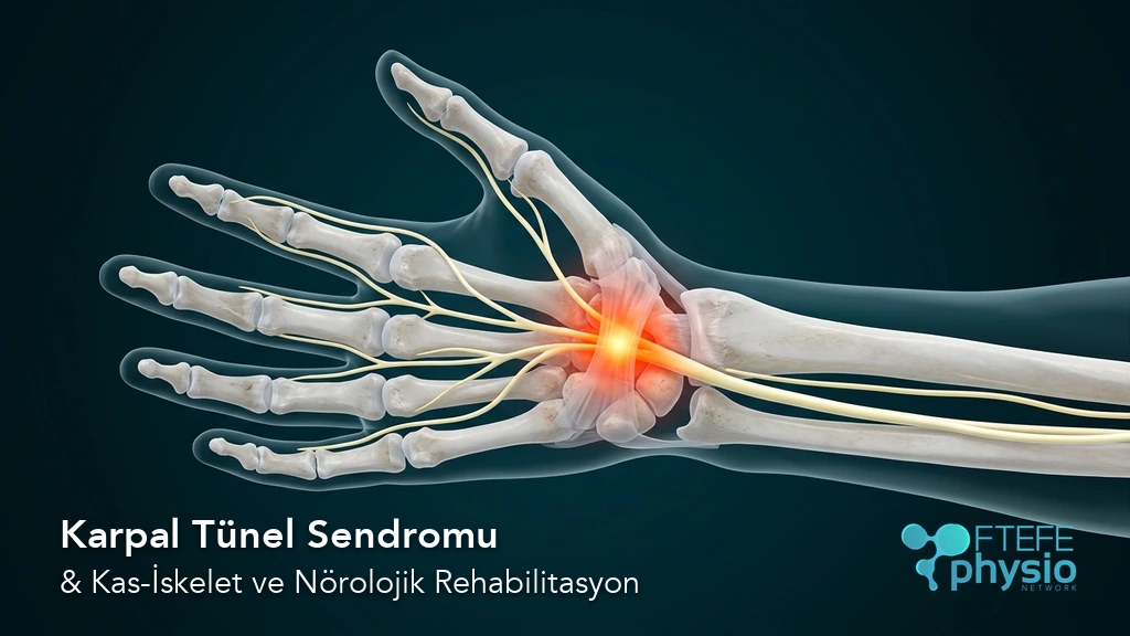 Karpal tünel sendromu ve median sinir basısı 3D el anatomisi